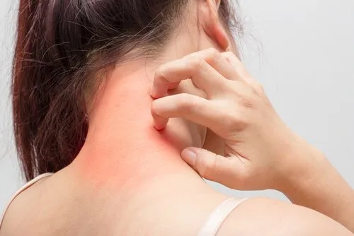Atopiskais dermatīts 6 padomi tā ārstēšanai