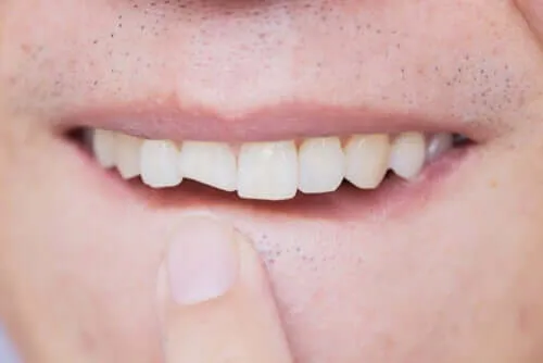 Čo znamená snívať o strate zubov?