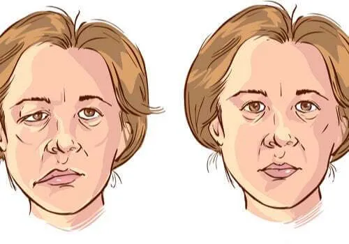 Ilustrácia ženy's face.' title='Ochrnutie tváre a sociálne dôsledky